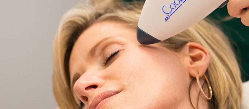Intensif Micro-Needling With Radio Frequency