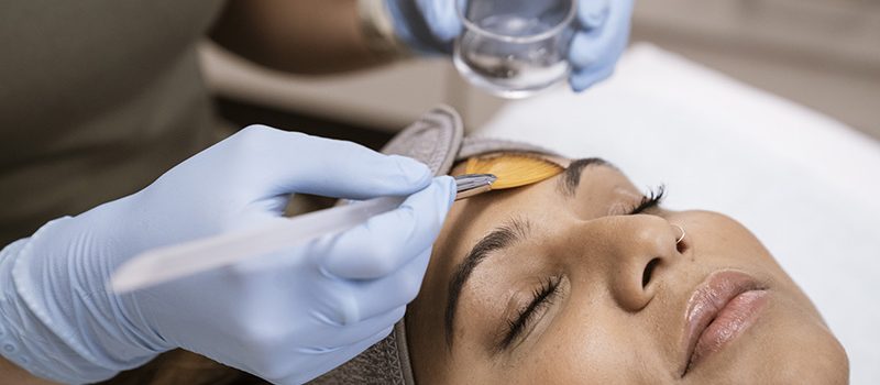 What Is a Chemical Peel and Why Is It So Popular?